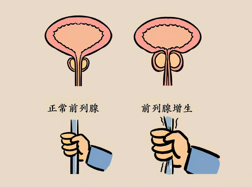 ewss15.png