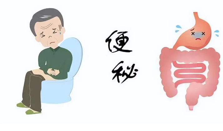 经常便秘的人这些食物不要吃